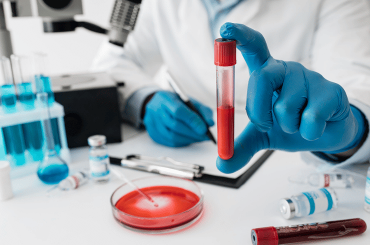 Blood Tests